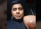 হাসনাতের ওপর হামলা:  গাজীপুরে রাতভর অভিযান, আটক অন্তত ৭০