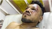 ২৪২ আরোহীর মধ্যে একমাত্র জীবিত যাত্রী বিশ্বাস কুমার