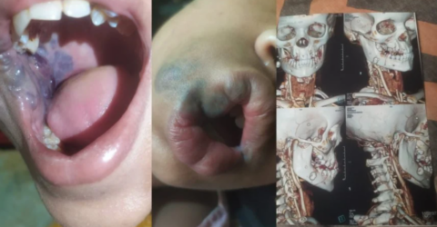 ১২ বছরের শাবানার চিকিৎসায় সহায়তা চান অসহায় মা